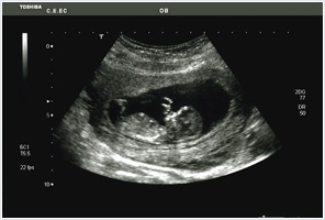 ecografia obstétrica