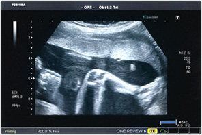 ecografia obstétrica