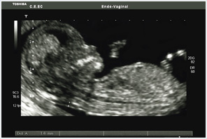 ecografia obstétrica