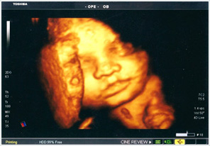 ecografia obstétrica 3D